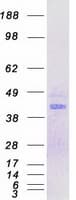 Human MNX1 / HB9 Protein (Recombinant Myc-DDK (Flag))
