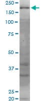 WRN Antibody (clone 2F7)