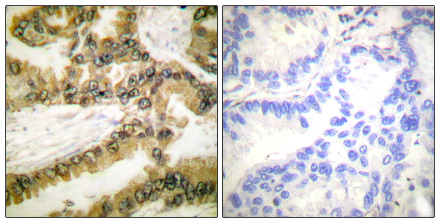 AKT1 Antibody (phospho-Thr450)