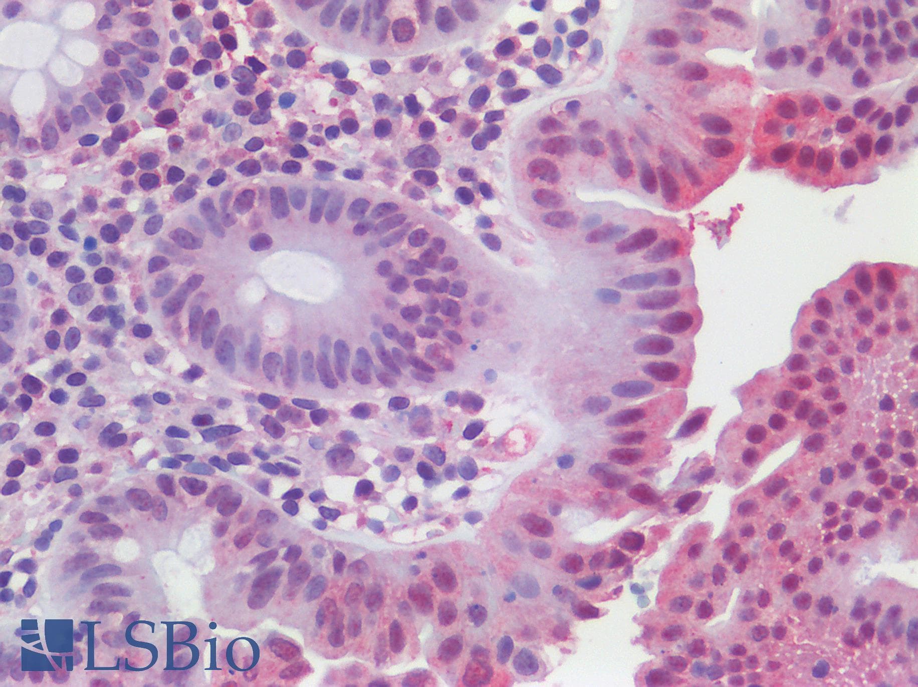 IHC-plus™ Polyclonal Rabbit anti-Human ATG16L1 / ATG16L Antibody (IHC, IF, WB)