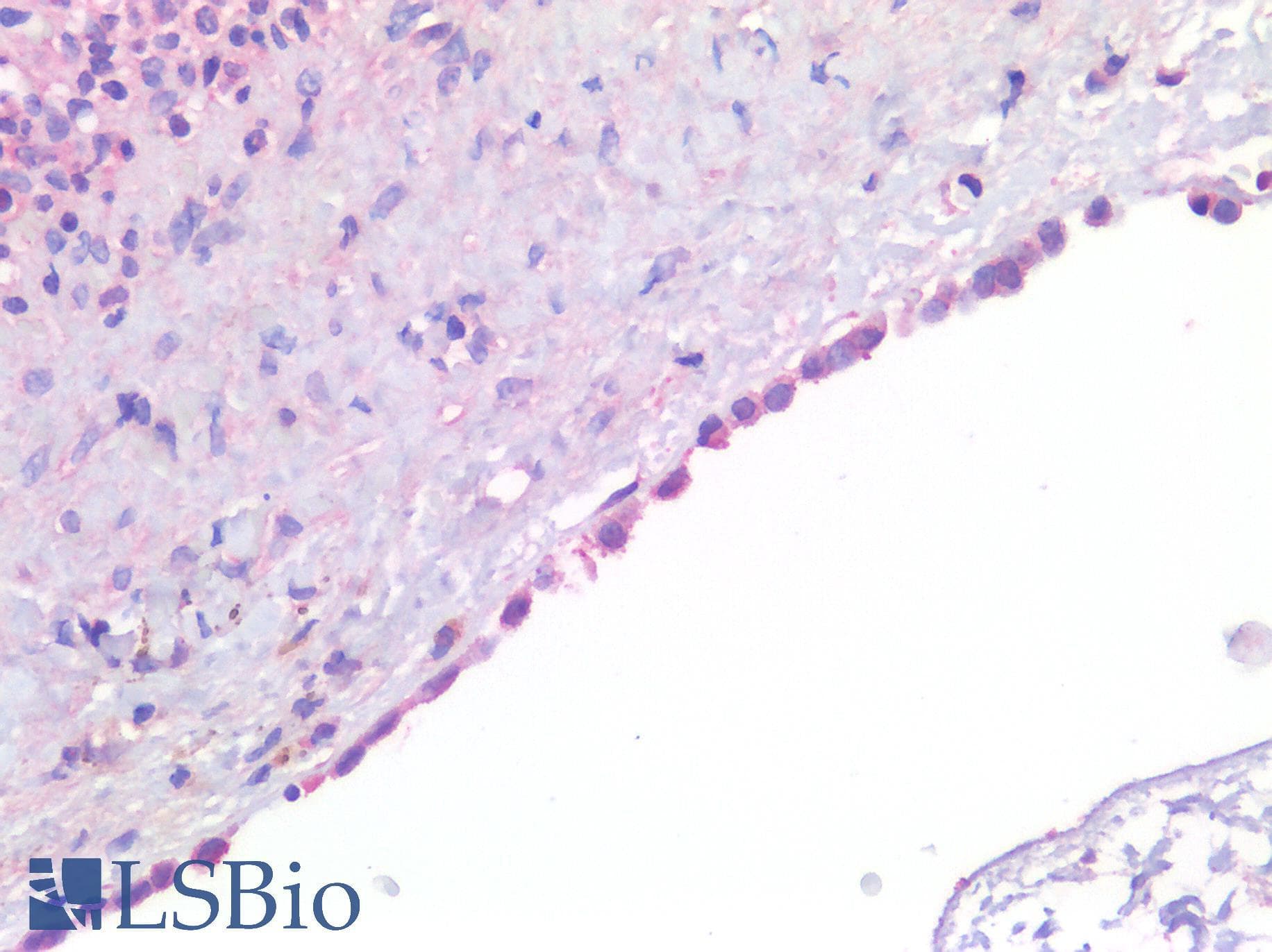 IHC-plus™ MSLN / Mesothelin Antibody