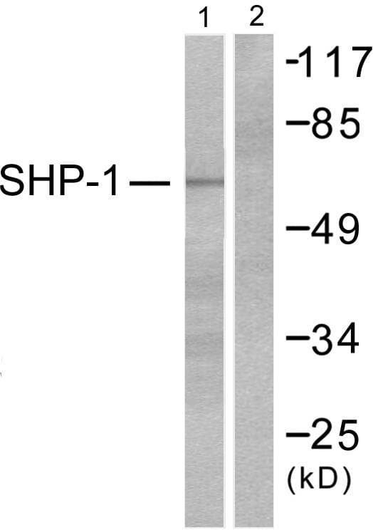 Polyclonal Rabbit anti-Human PTPN6 / SHP1 Antibody (p536, IHC, WB)