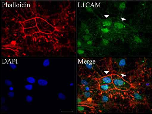 L1CAM Antibody (clone UMAB47)