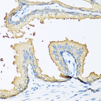 CCN3 / NOV Antibody
