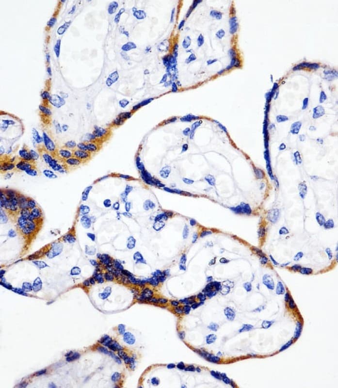PPIB / Cyclophilin B Antibody