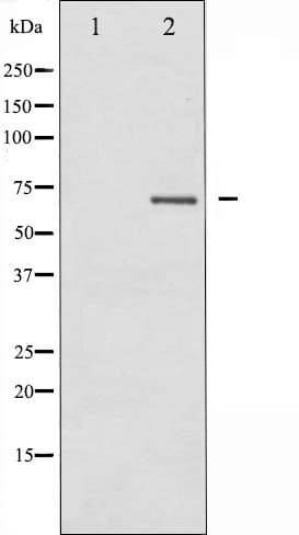 PRKCB / PKC-Beta Antibody