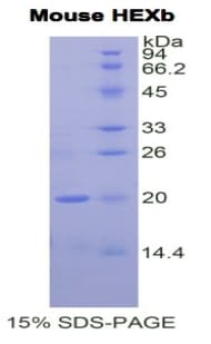 Mouse HEXB Protein (Recombinant His)