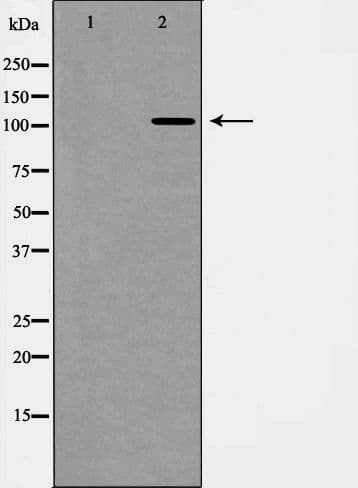 EPHA1 / EPH Receptor A1 Antibody