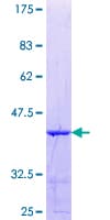 Human PARG Protein (Recombinant GST, N-terminus)