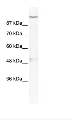 Polyclonal Rabbit anti-Human KCNH6 / Kv11.2 / ERG2 Antibody (aa628-677, IHC, WB)