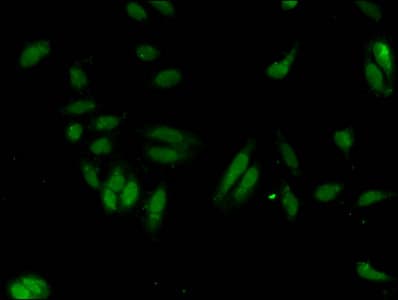 Polyclonal Rabbit anti-Human HIST1H3A Antibody (IHC, IF)