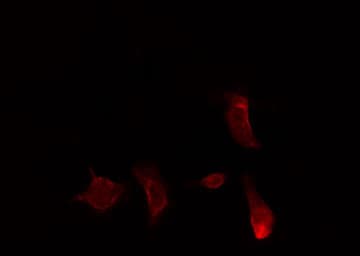 CAMKK2 Antibody