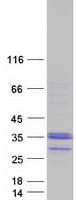 Human C1QL3 Protein (Recombinant Myc-DDK (Flag))