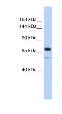 CALD1 / Caldesmon Antibody (aa467-516)