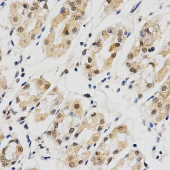 SNRPE Antibody