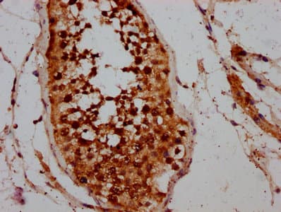CCIN / Calicin Antibody