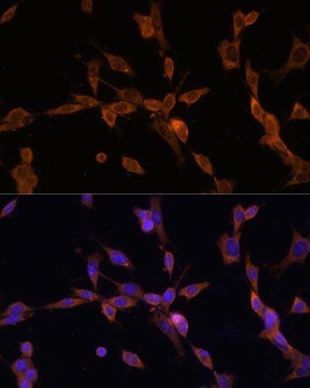 Ubc6p Homolog (HSU93243) (UBE2J1) Antibody