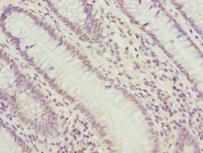 PLK1 / PLK-1 Antibody