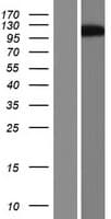 ARHGAP26 / GRAF Protein (Over-Expression Lysate Myc-DDK (Flag))
