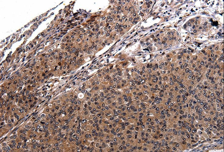 Polyclonal Rabbit anti-Human RAB41 Antibody (IHC)