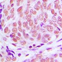 KLF11 Antibody (N-Terminus)