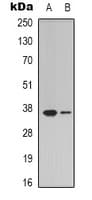 ZDHHC20 Antibody (Internal)