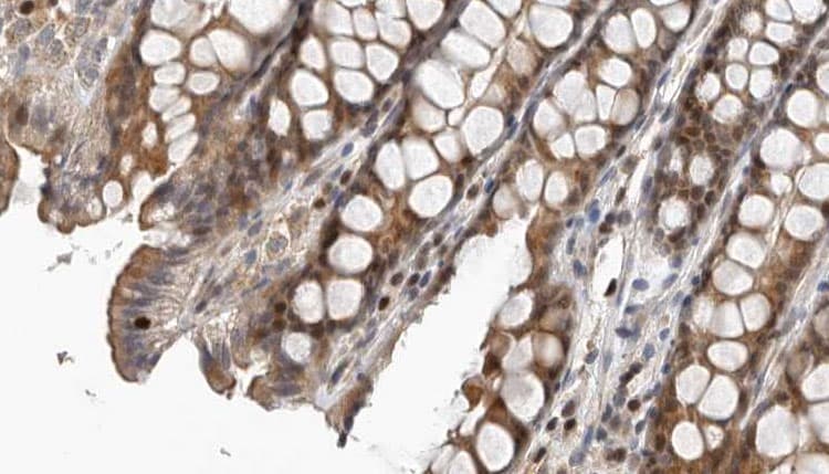 NCF1 / p47phox / p47 phox Antibody (phospho-Ser359)