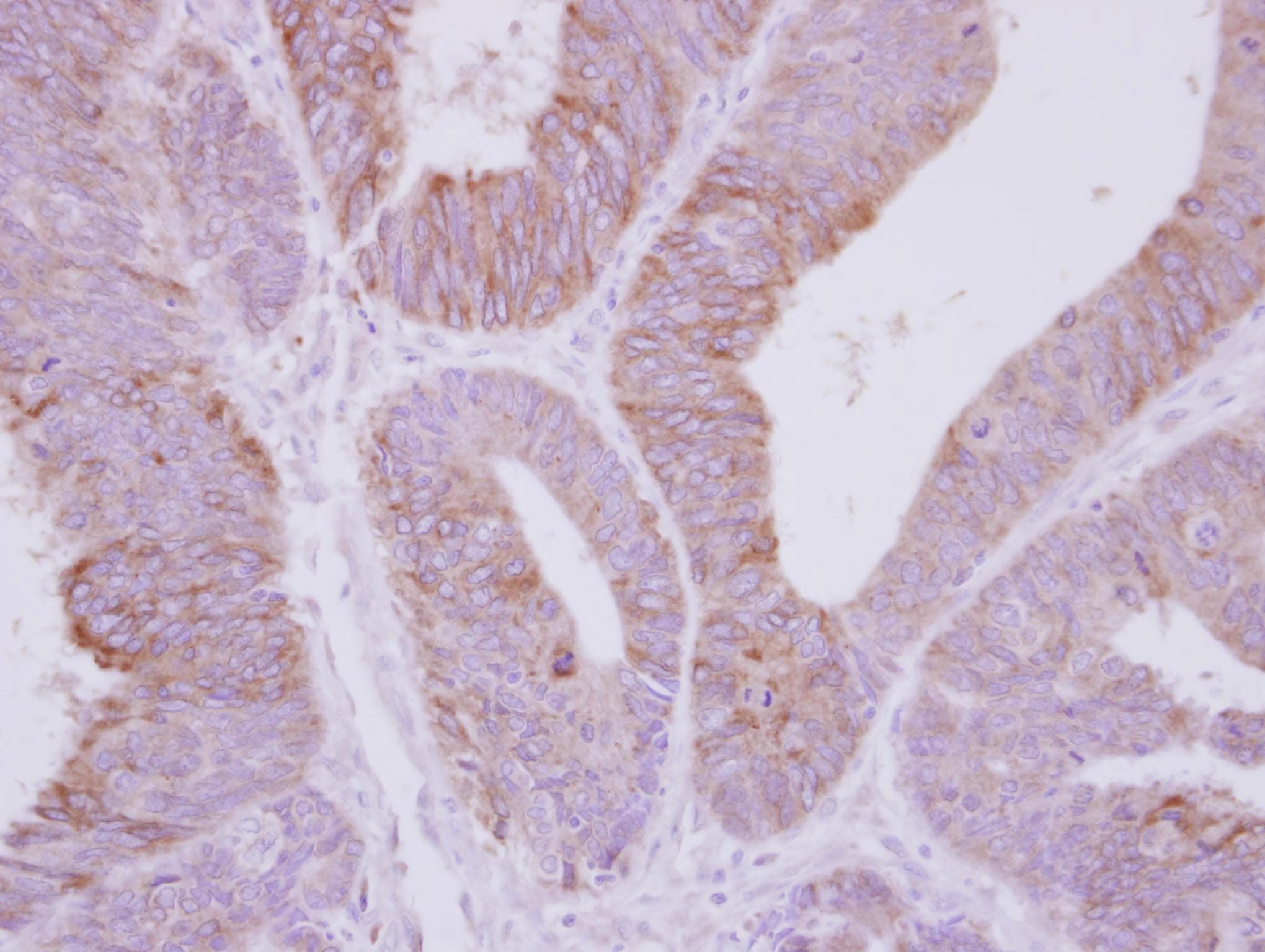 Polyclonal Rabbit anti-Human PPP2R3A / PR130 Antibody (C-Terminus, IHC, WB)