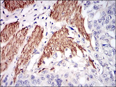 NPC / NPC1 Antibody (aa34-174, clone 8D10B6)