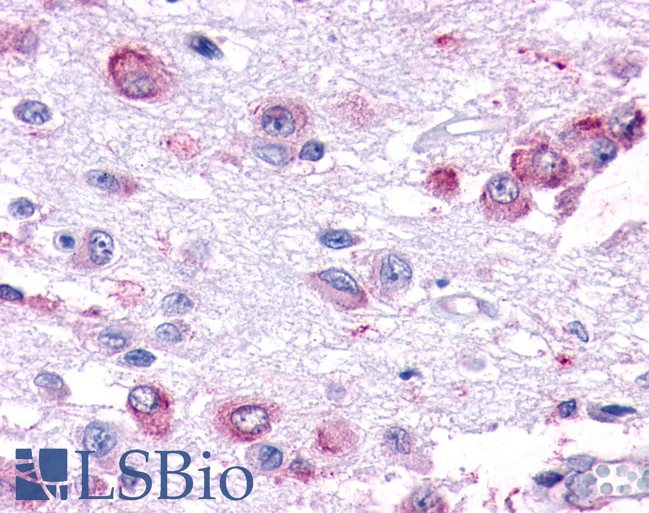PathPlus™ GPCR6 / GPR101 Antibody (Cytoplasmic Domain)