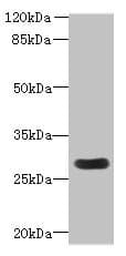 Polyclonal Rabbit anti-Human MORN3 Antibody (WB)
