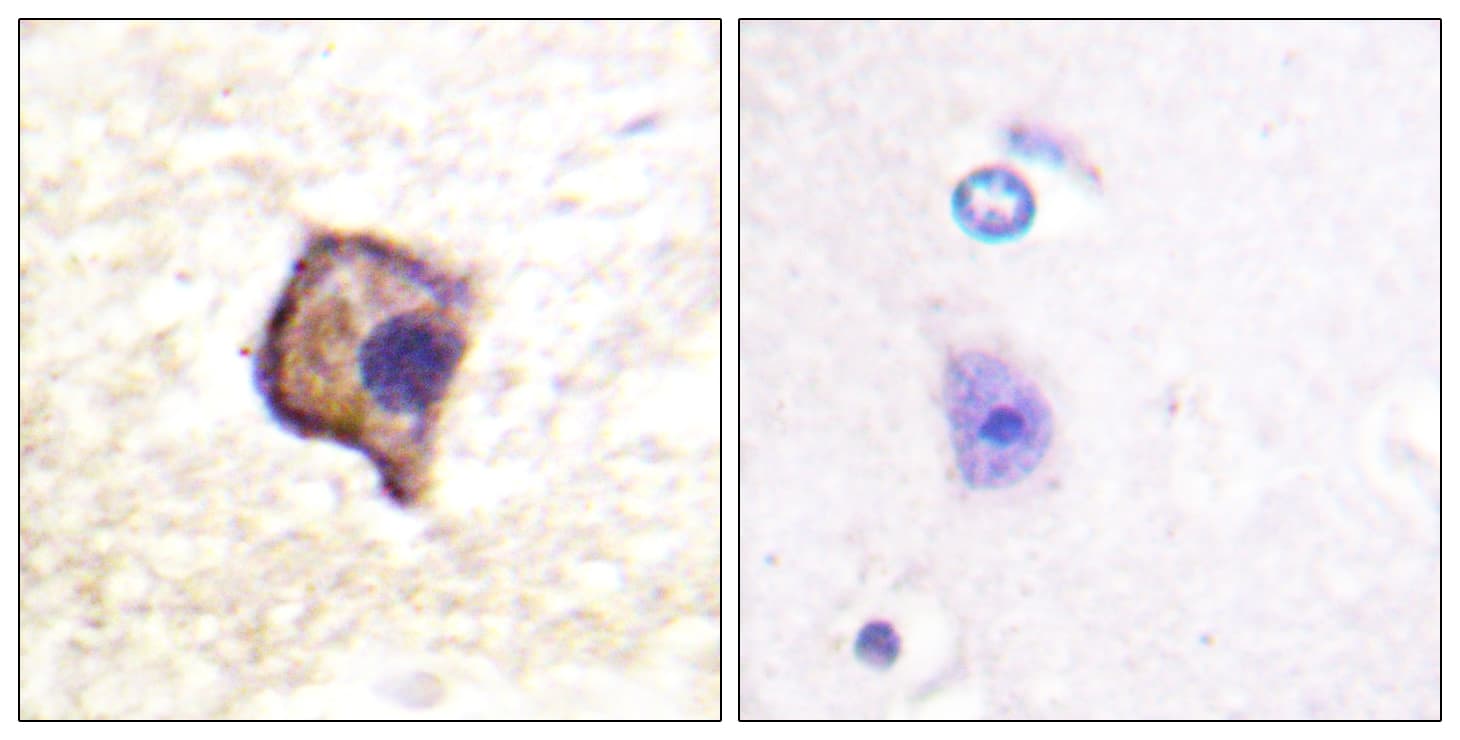 RET Antibody (aa881-930)