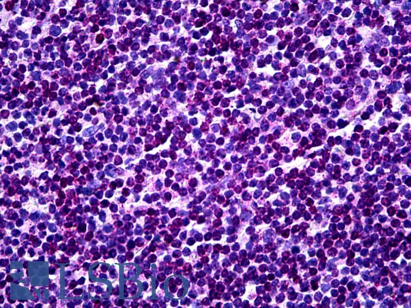 IHC-plus™ MKNK1 / MNK1 Antibody (clone 2F12)