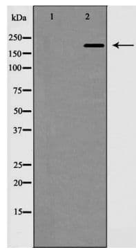 Polyclonal Rabbit anti-Human MAP2 Antibody (IHC, WB)