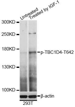 TBC1D4 / AS160 Antibody (phospho-Thr642)
