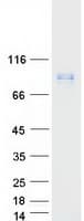 Human LMOD1 Protein (Recombinant Myc-DDK (Flag))
