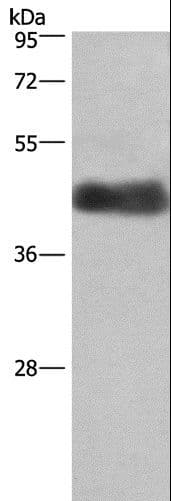 Polyclonal Rabbit anti-Human CALU / Calumenin Antibody (IHC, WB)