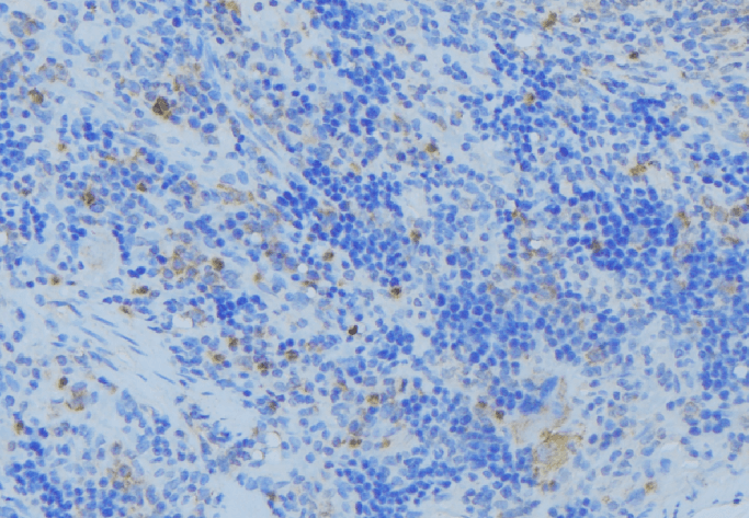 KRT33A / Keratin 33A / KRTHA3A Antibody