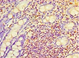 RAB6A / RAB6 Antibody (aa2-208, HRP)