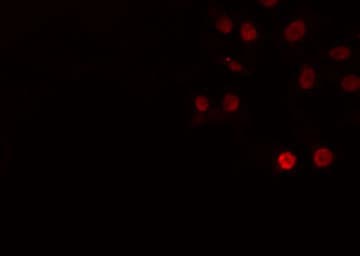ERCC5 / XPG Antibody