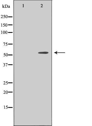 PRKACB Antibody
