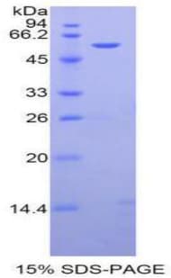 Human AHSG / Fetuin A Protein (Recombinant His-GST)