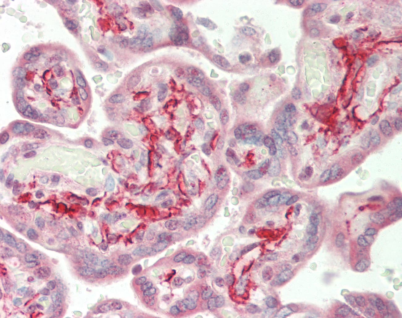 AXL Antibody (C-Terminus)
