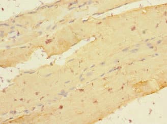 LDB3 / ZASP Antibody