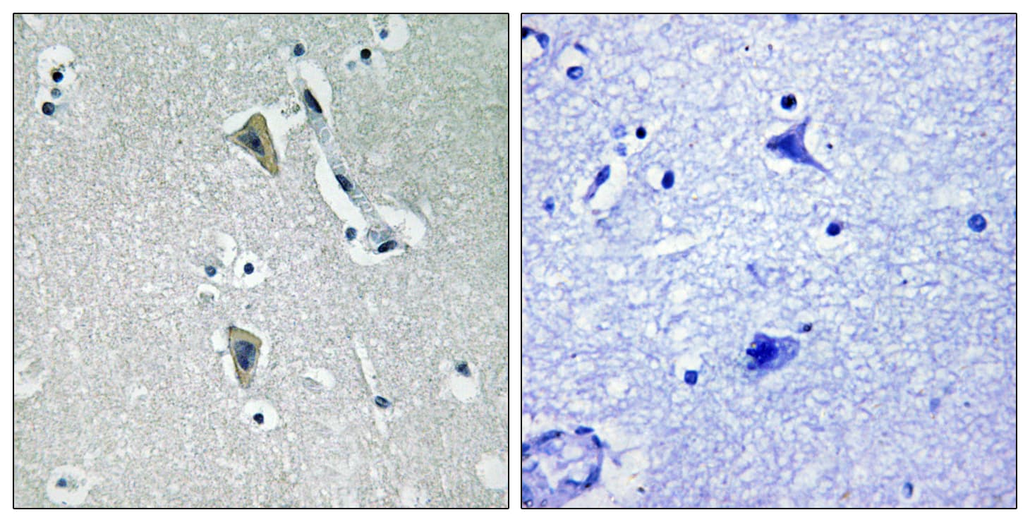 PRKCQ / PKC-Theta Antibody (phospho-Thr538)