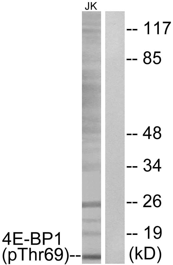 EIF4EBP1 / 4EBP1 Antibody (phospho-Thr69)