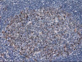 DLD / Diaphorase / E3 Antibody (clone OTI4D5)