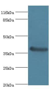 CA12 / Carbonic Anhydrase XII Antibody (aa25-301)