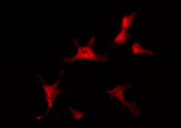CTNNB1 / Beta Catenin Antibody (phospho-Ser37)
