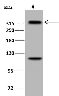 Polyclonal Rabbit anti-Human SETD2 Antibody (WB)
